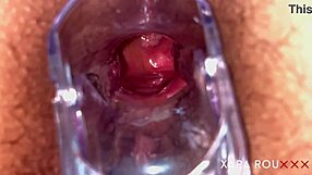 Beautiful MILF gets her ass fucked with a speculum